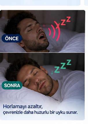 Horlama ve Diş Gıcırdamasını Önleyici Ayarlanabilir Dişlik